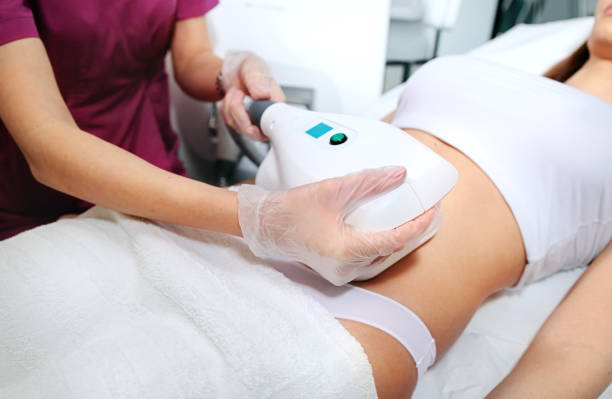 Attractive woman in white bikini getting Cool sculpting procedure for body slimming. Cryolipolyse and body contouring treatment, anti-cellulite and anti-fat therapy in beauty salon