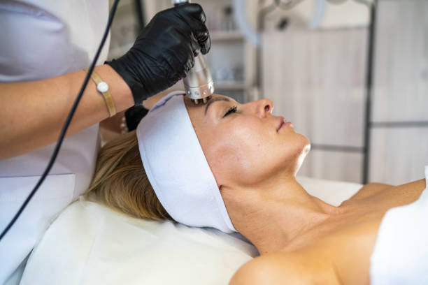 Woman getting rf-lifting on face